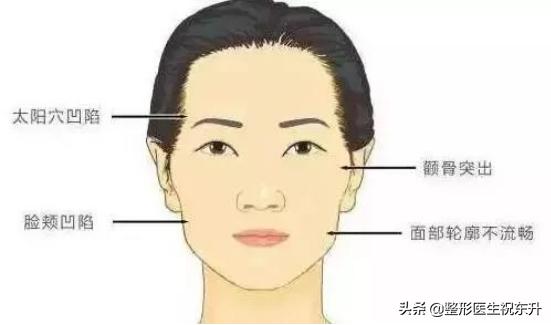 颧骨高年纪大了凹陷,颧骨高太阳穴凹陷没福气