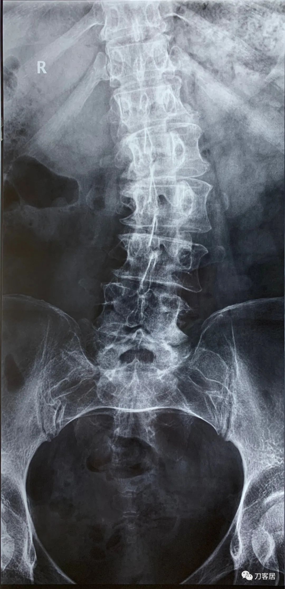 我的门诊病历,我的门诊