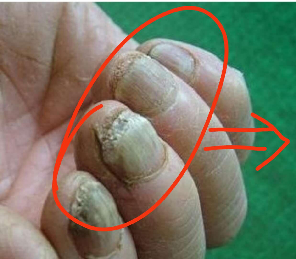 指甲变黄变空该不该剪,指甲变白变空变脆了是怎么回事