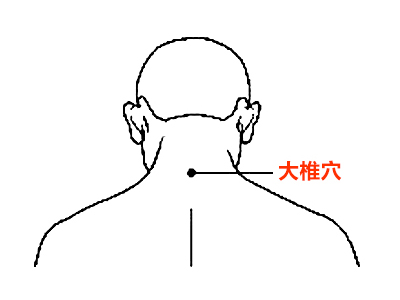 流感反复高烧39度以上3天仍未退烧,儿童乙型流感高烧不退的处理方法