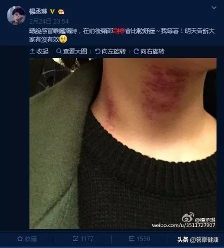 年过三十面部下垂，告诉你提拉紧致的秘技