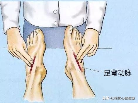 引起下肢动脉硬化原因是什么,下肢动脉硬化疼痛如何缓解