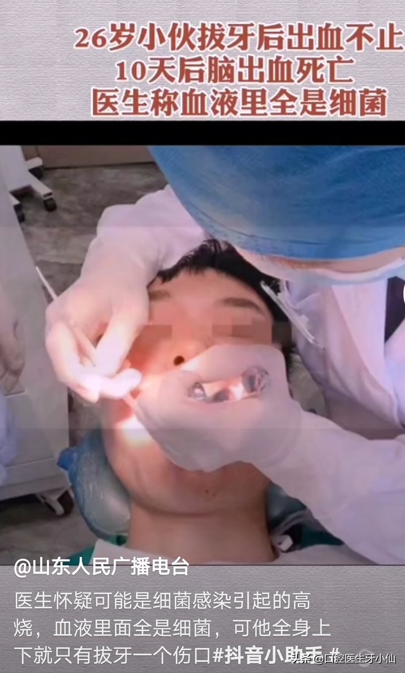 拔牙流血过程,拔牙后出血自我处理小妙招