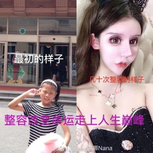 做6次双眼皮4次鼻子，下巴似铁锥眼睛整成球，16岁就整成这样好吗