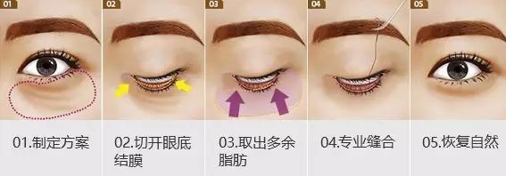 导致衰老的是哪个器官,导致衰老的原因