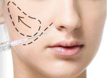 法令纹苹果肌下垂有什么办法改善,如何改善法令纹和苹果肌下垂