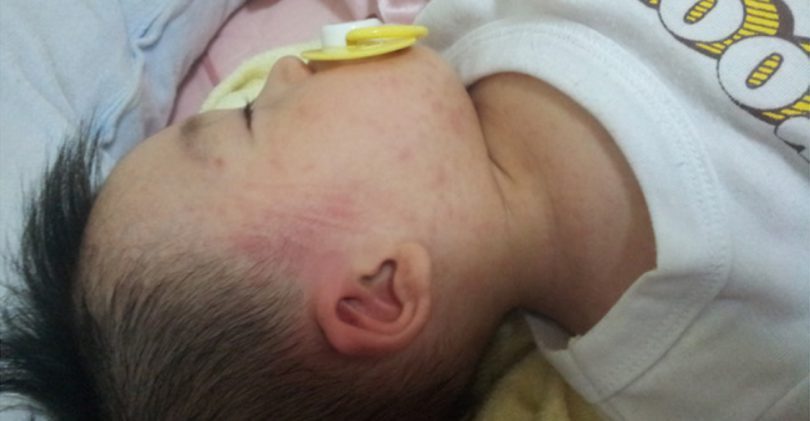 宝宝感染性发烧如何处理,3周岁孩子发烧39.5度其他症状没有