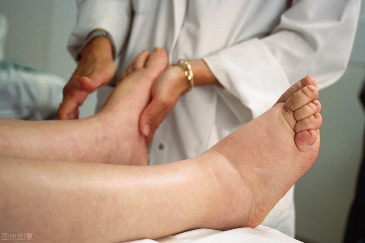 双下肢水肿挂哪个科,孕期双腿浮肿怎么调理