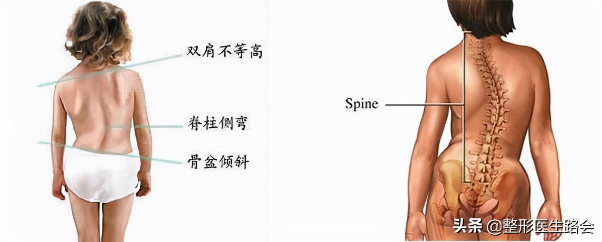 这6个坏习惯会让你越来越胖,这6种坏习惯会毁了孩子一生