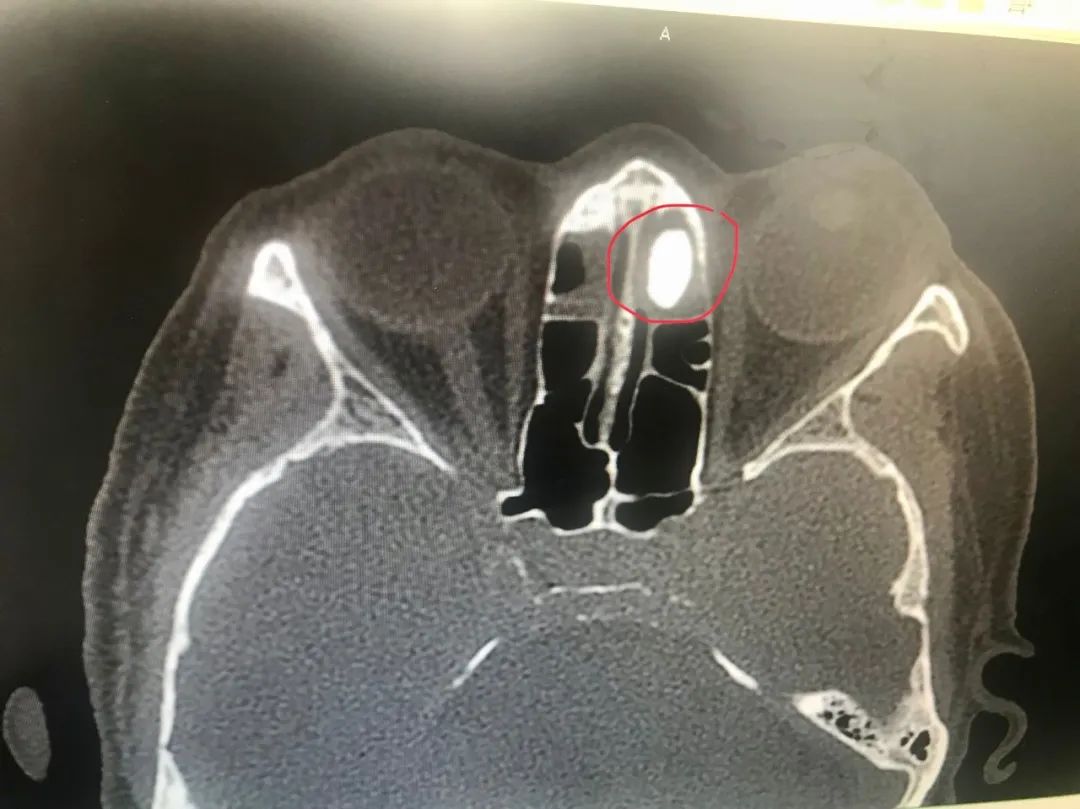 辽阳市第二人民医院耳鼻喉,辽阳市中医医院耳鼻喉科