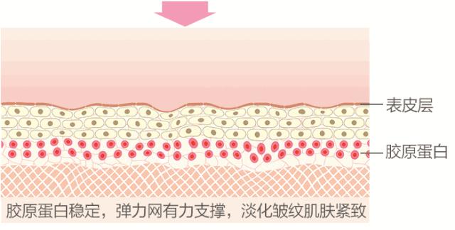 热拉提2.0好还是热玛吉好,热拉提跟热玛吉哪个性价比高