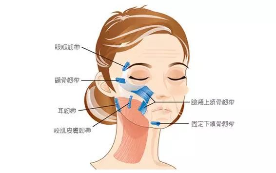 想做埋线有什么建议,想做线雕