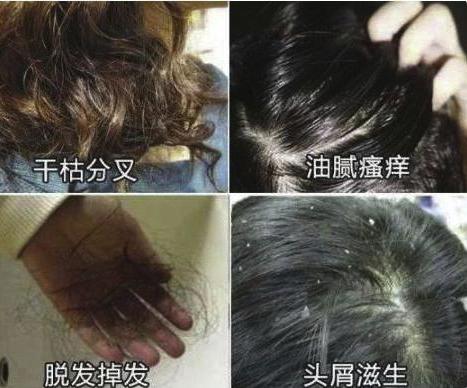 戚薇袁咏仪推荐的洗发水,袁咏仪同款洗发水