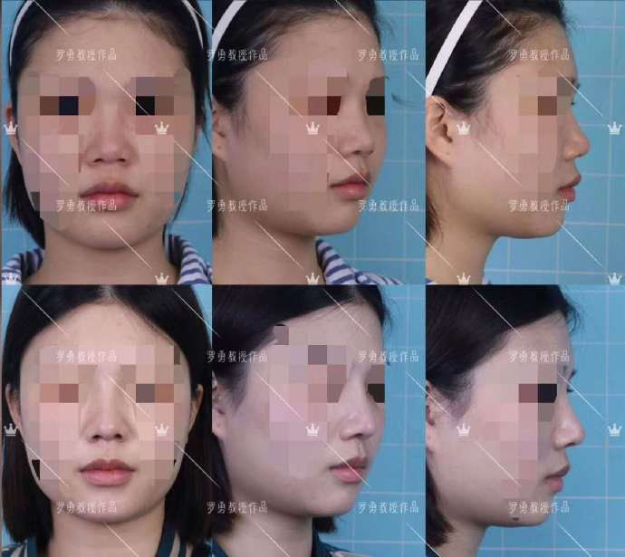 什么样的鼻子好看,怎样的鼻子才是好看的鼻子