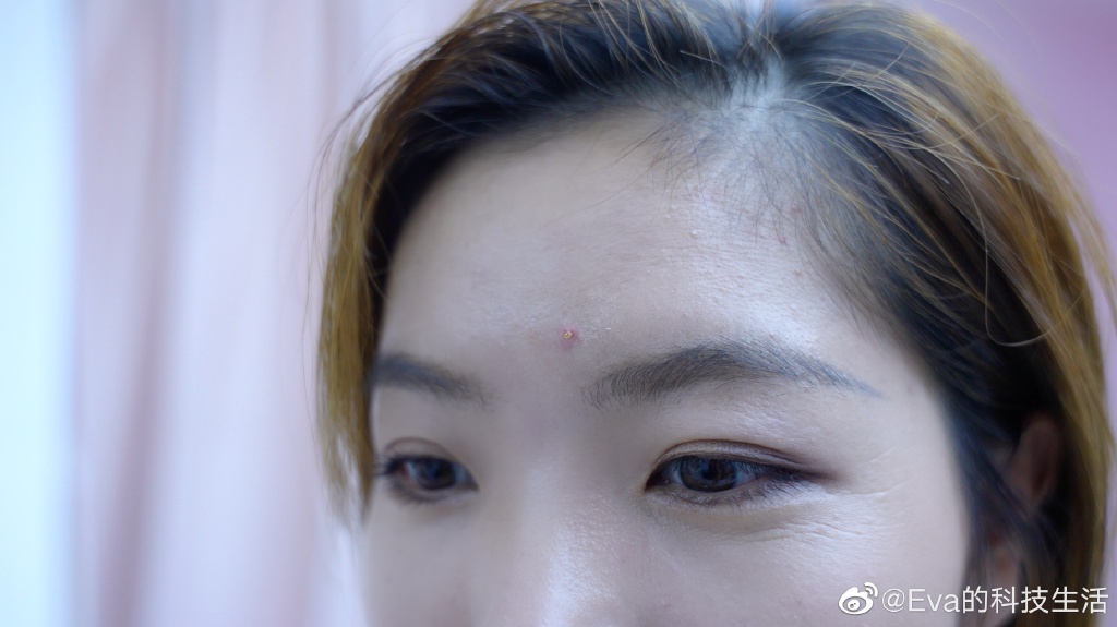 小米Civi自拍效果有多强？知名数码博主晒自拍，痘痘神奇的消失了