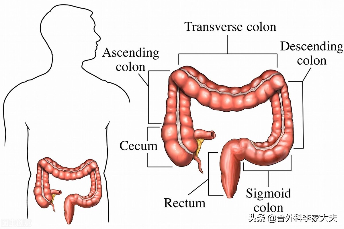 结直肠中，为什么乙状结肠、直肠部分肠癌发病率高？