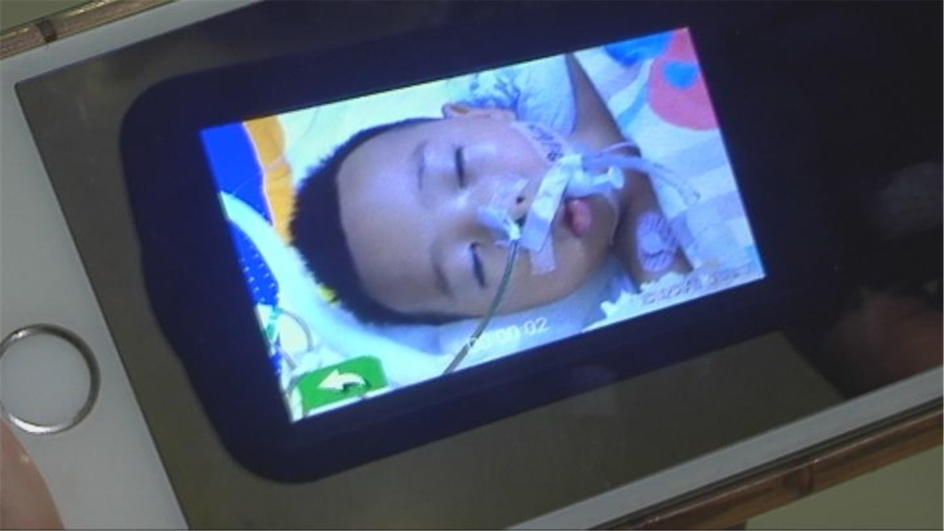 小孩重度急性脑炎的治愈率,小孩重度脑炎治疗一般几天好转