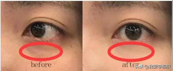 雅诗兰黛眼霜去细纹效果怎么样,雅诗兰黛祛眼纹吗