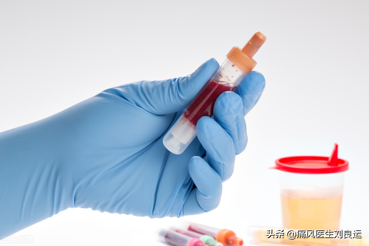 痛风患者查尿酸前能不能吃药,患了痛风到医院要做哪些检查