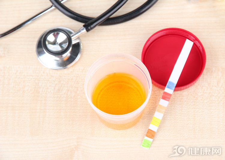 尿蛋白提示neg,尿蛋白会误诊吗