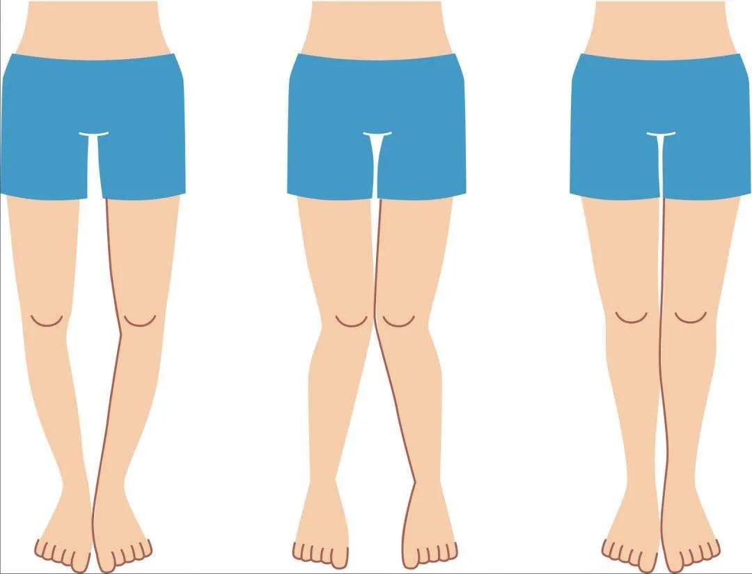 关注“跑偏”的鞋子,提示你的健康问题!