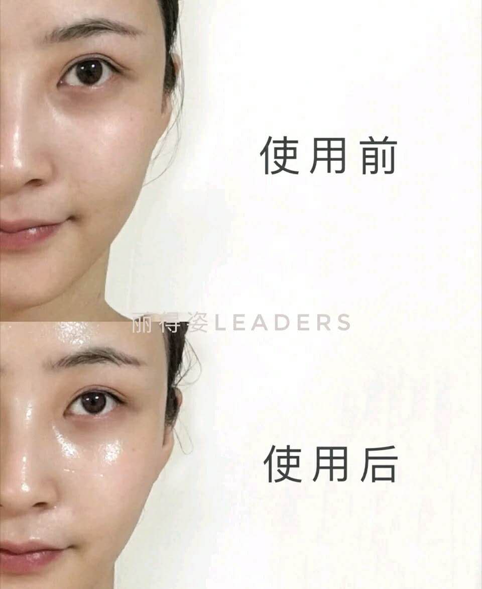 屈臣氏面膜补水推荐,屈臣氏补水保湿祛痘面膜