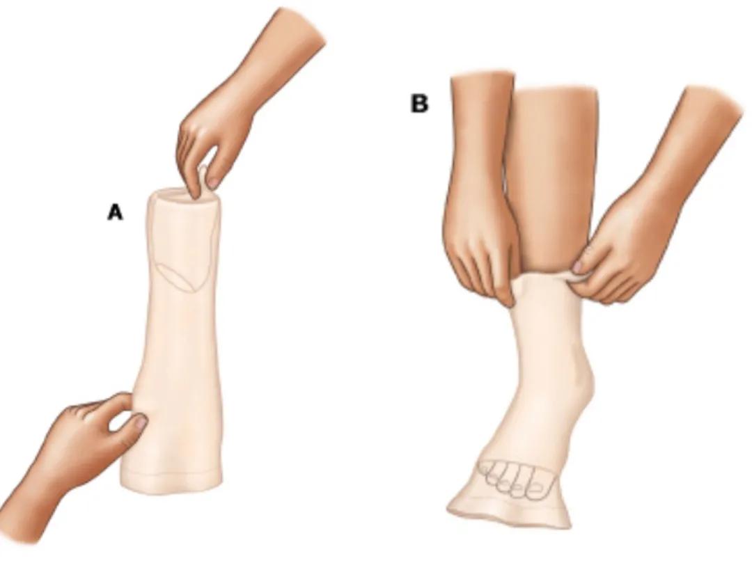 防静脉曲张的医用弹力袜瘦腿,瘦腿袜能缓解预防静脉曲张吗