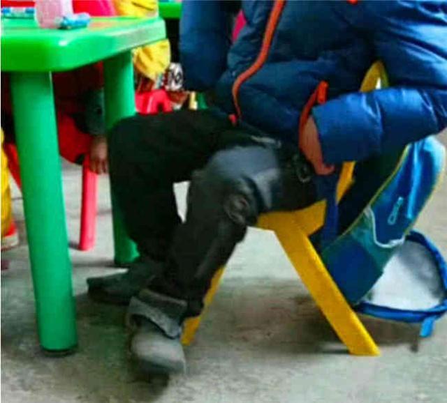 孩子总是抖脚是怎么回事,为什么小孩会频繁抖头发