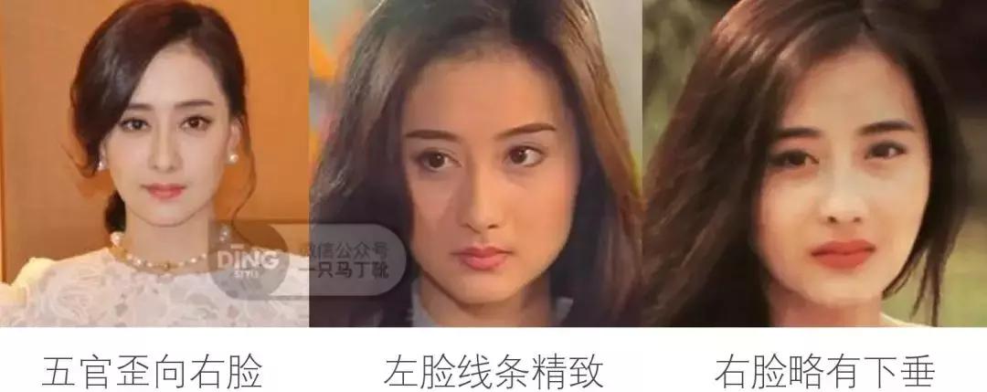 脸大小不对称怎么矫正,如何改善大小脸不对称