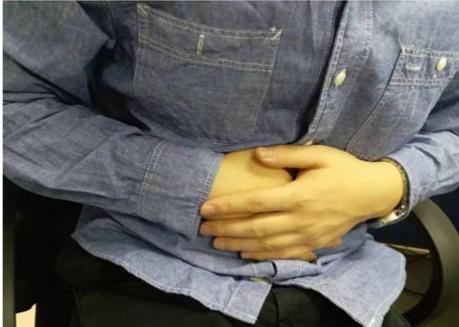 结肠癌的早期症状，请对照自评