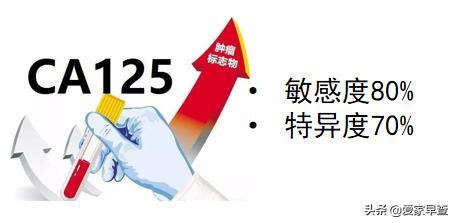 哪些女性易被卵巢癌“盯上”？如何防护？