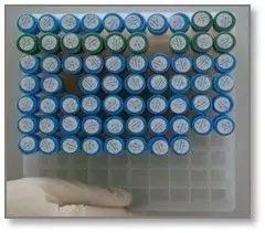 协和医院风湿科发展历程,协和类风湿专家