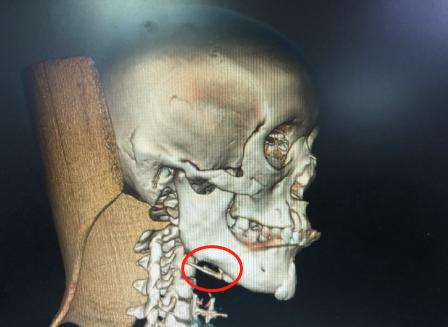 整形医生如何提高审美,十年前的整形审美和现在的审美