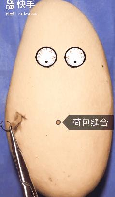 香蕉割包皮,洋葱剖腹产?这是我见过最秀的医生