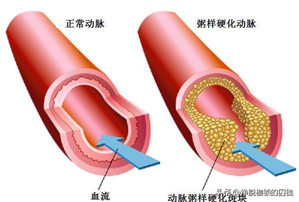 美国研究少吃饭增长寿命,美国研究饭量大小与寿命有关