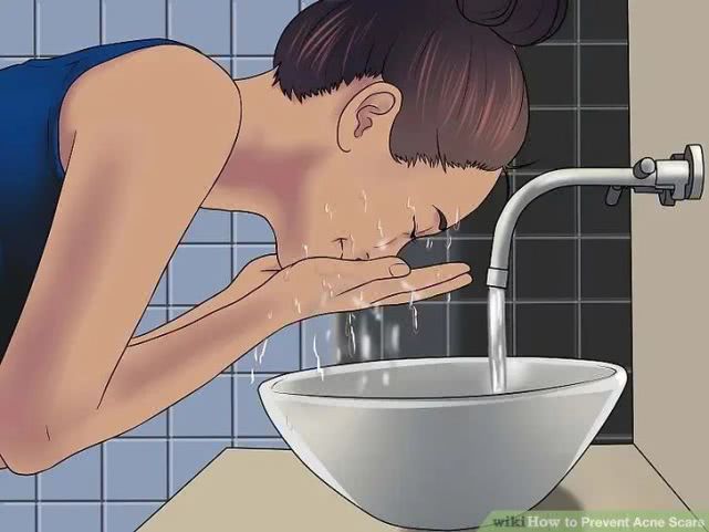 长完痘的红色痘坑怎么弄,怎么预防痘坑形成