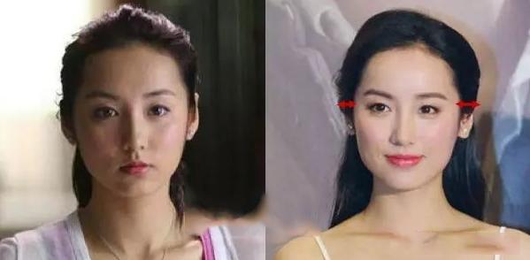 脸大怎么办自救方法,颅顶低的女生拯救办法