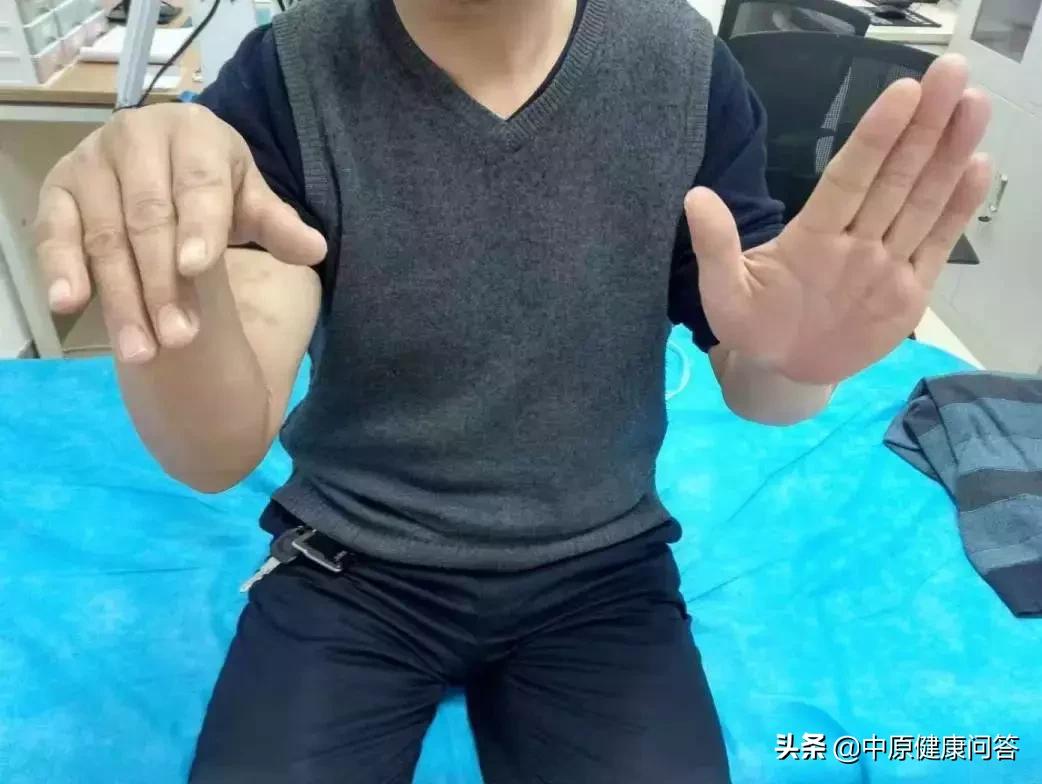 酒后手发麻僵硬,男子醉酒失去意识