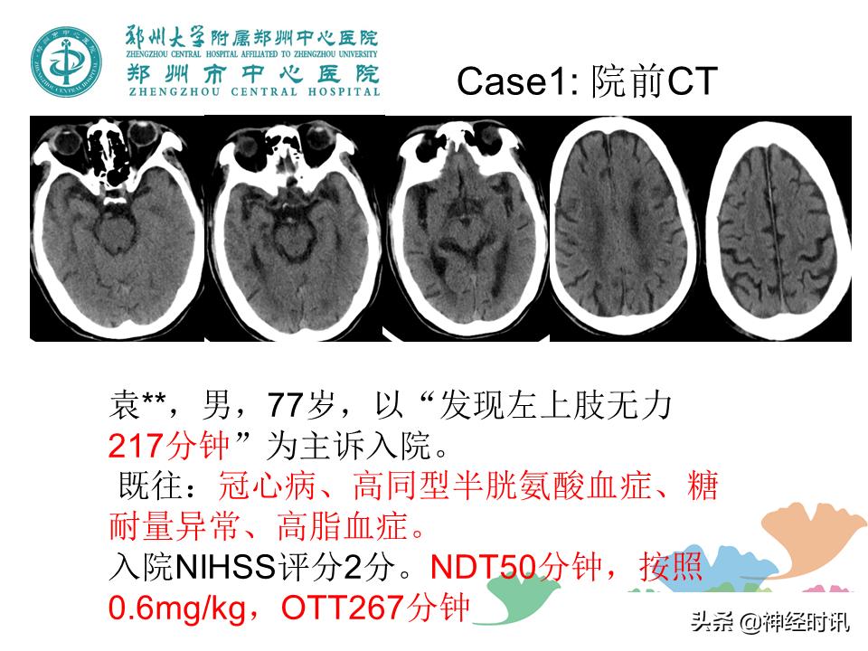 静脉溶栓怎么引起的,静脉相关并发症的预防及处理