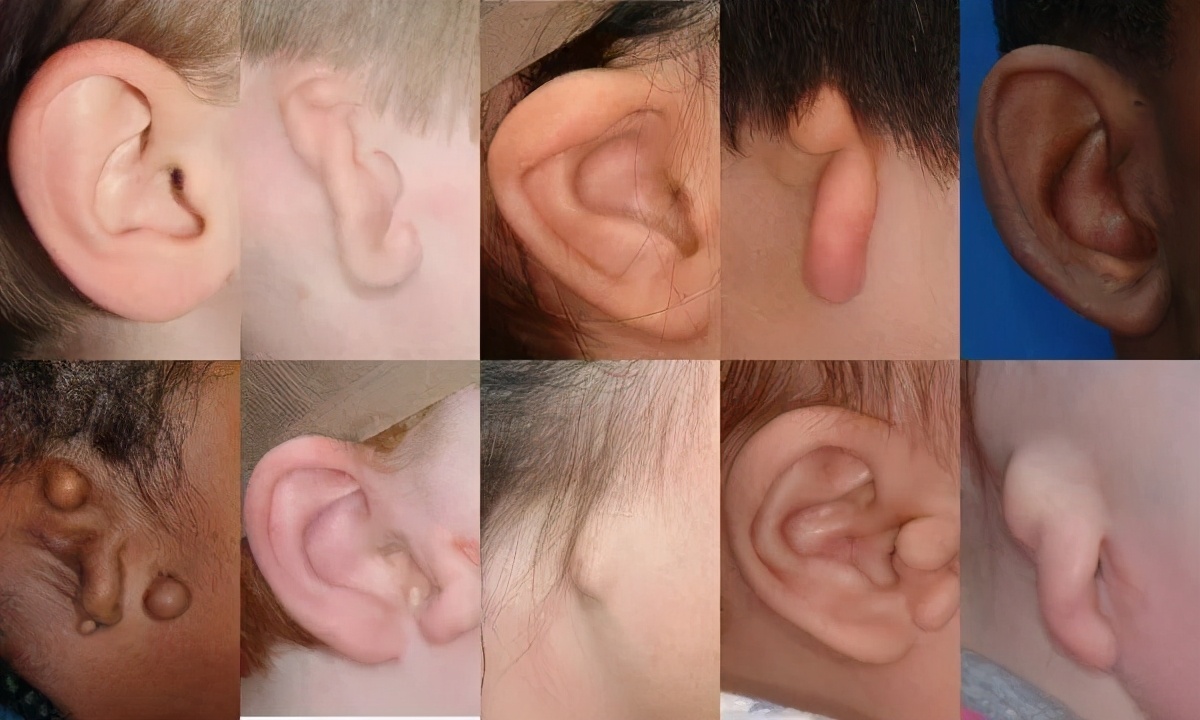 孩子六岁了父母应该注意哪些,小耳畸形的孩子要生吗