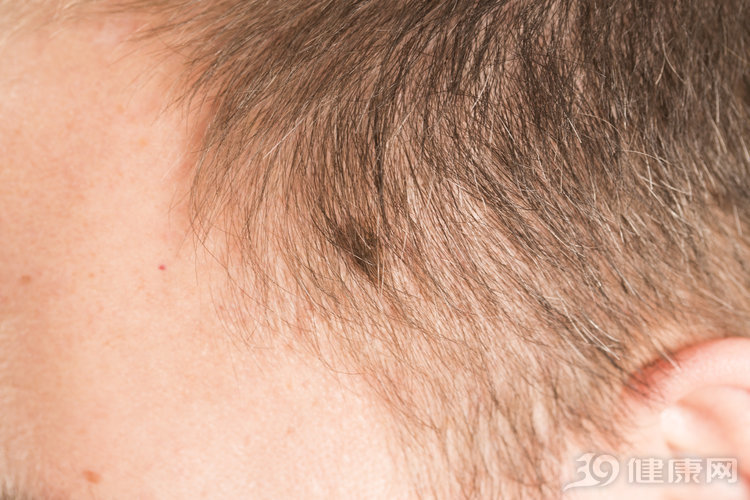 脚上莫名长了个痣是皮肤癌吗,有皮肤癌前兆的痣切掉就没事了吗