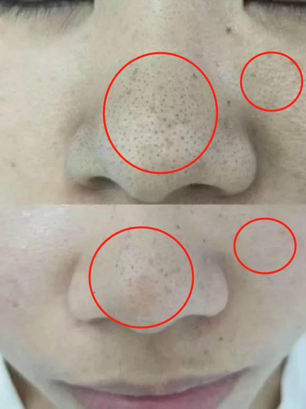 我国最“憋屈”洁面乳，明明有“香奈儿”的实力，却常被误是街货