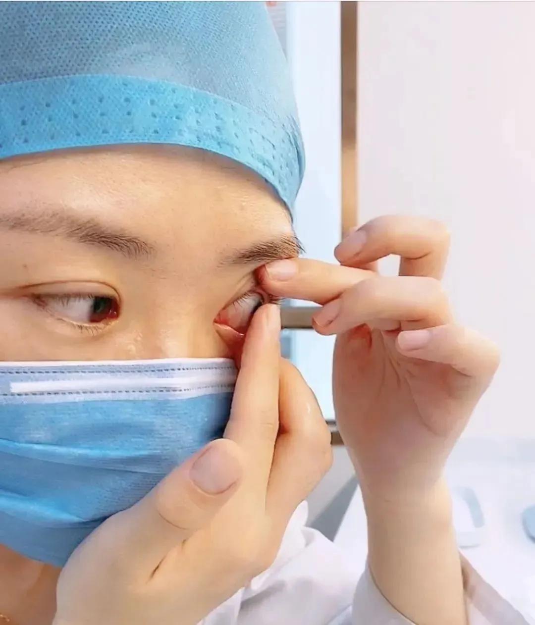 眼科医生隐形眼镜怎么摘取,隐形眼镜怎么摘新手