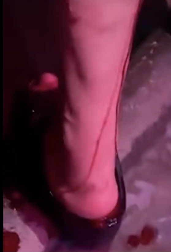 咬伤女童黑犬如何处置,被野狗咬伤如何索赔找不到主人