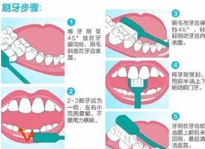 天冷牙就酸疼怎么回事,牙又酸又冷怎么办
