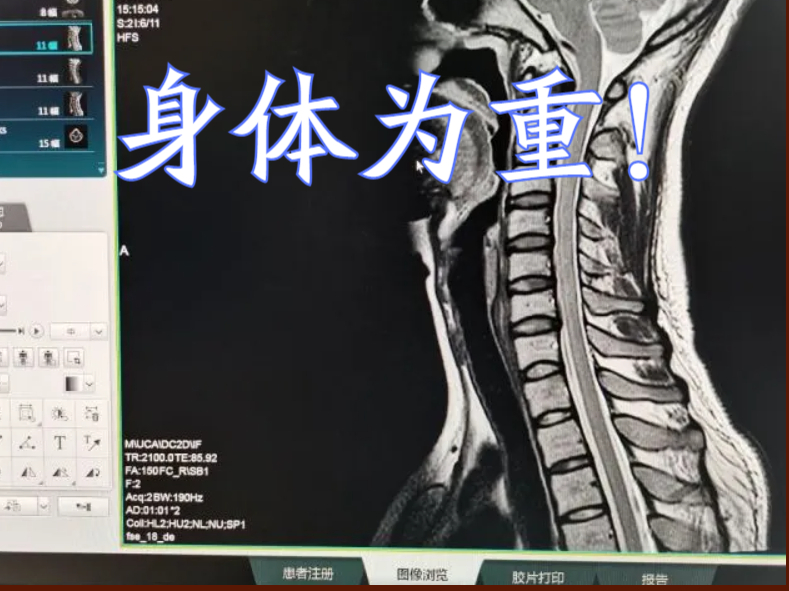 魔兽tbc风暴前夕,魔兽世界tbc前夕四大机制改动