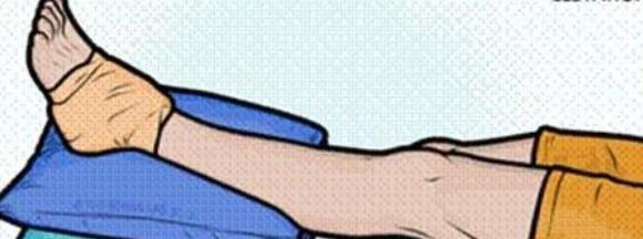 骨科医生告诉你崴脚了怎么办,急性脚扭伤正确的处理方法