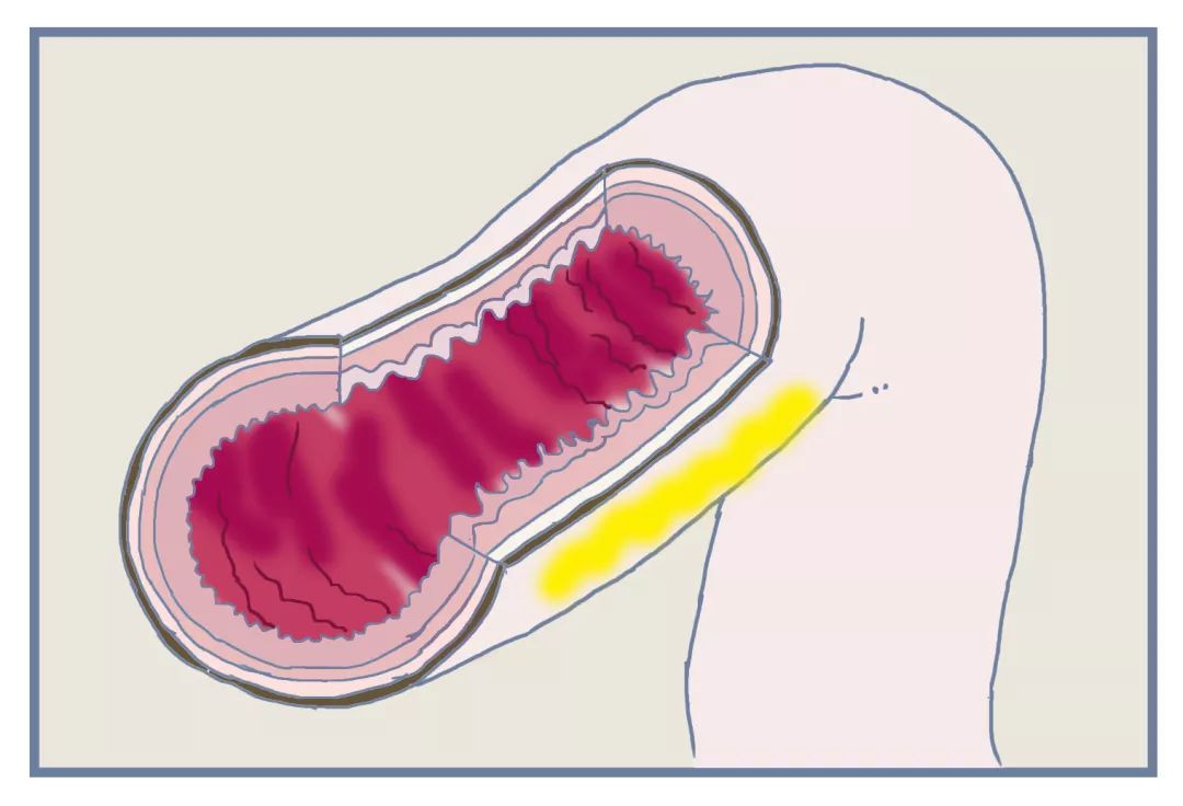 便秘在药店推荐的药品,大家都在用什么药治疗便秘