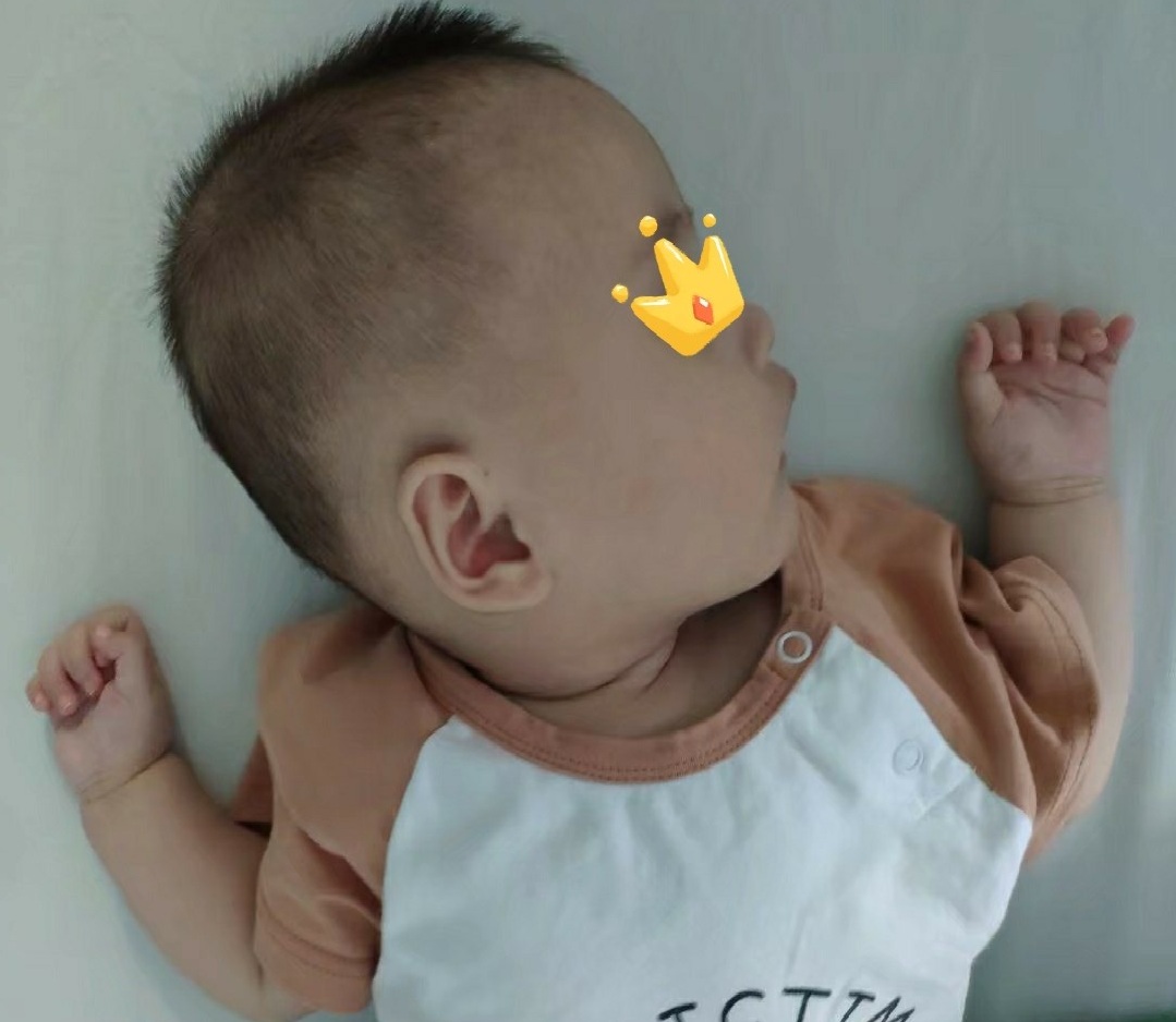 孩子睡扁头有什么说法,孩子睡扁头还是圆头好