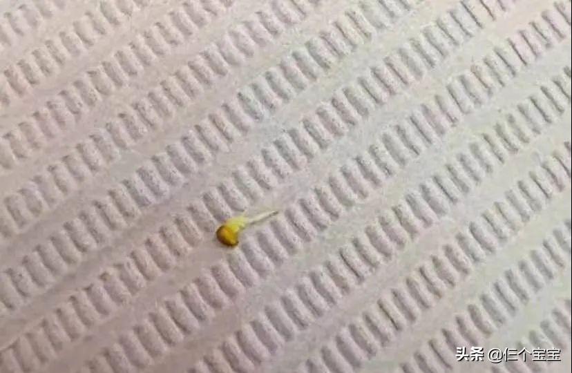 草莓籽藏在牙里发芽了,草莓籽在嘴里发芽